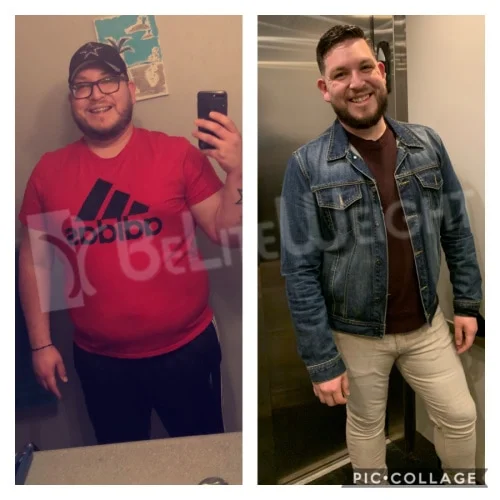 Gastric Sleeve Jeremy S - 18 Month Update*